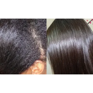 Plástica dos Fios - Kit Shampoo Pré-Tratamento 1L + Selagem Térmica 1L + Botox 1Kg - Único