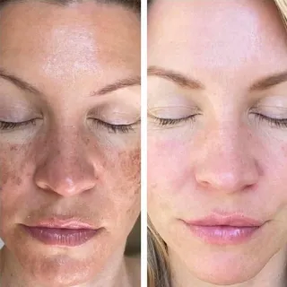 Max Love Sérum Facial Vitamina C - Ação Potente Antioxidante - Único