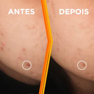 Vitamina C Sérum Facial Uniform & Matte Garnier Antimarcas, 30ml - Único