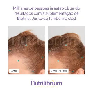 Biotina Nutrilibrium + Ácido Hialurônico Premium Kit Colágeno Verisol - Abacaxi com Hortelã